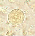 Cysts of Entamoeba coli | Medical Laboratories