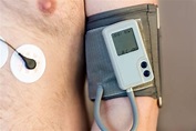 La MAPA es necesaria para medir la presión arterial en pacientes de ...