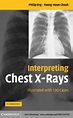 Interpreting Chest X-Rays - 1st Edition (eBook) in 2021 | Medical ...