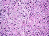 Pathology Outlines - PathologyOutlines.com