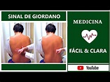 SINAL DE GIORDANO - SEMIOLOGIA DO EXAME FÍSICO - YouTube