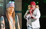 Axl Rose Before and After: The Evolution of a Rock Icon - The Artistree