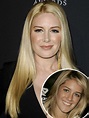 Heidi Montag 'almost died' during plastic surgery: See her transformation!