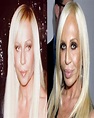 60 Worst Cases Of Celebrity Plastic Surgery Gone Wrong
