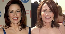 Has Patricia Heaton had Plastic Surgery Done Before and After Pictures