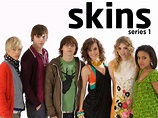 Watch Skins | Prime Video