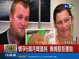 勇敢的媽媽! 澳洲女產下"雙臉嬰" - 華視新聞網