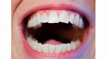 Todo Lo que pasa en la boca no se queda en la boca - Odontologos.com.co