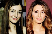 Nasim Pedrad's plastic surgery rumors - from Botox to nose job