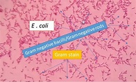 E. coli Gram stain: Introduction, Principle, Procedure and Result Interpret