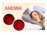 Causas de la anemia - El Men