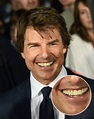 Tom Cruise Teeth Before And After Braces / Tom Cruise Braces Sale 60 ...