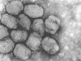 NIH新发现一例天花病毒样品| 果壳 科技有意思