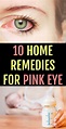 10 Amazing Home Remedies for Pink Eye You Can Trust | Pinkeye remedies ...