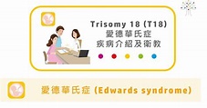 愛德華氏症Trisomy18（Edwards syndrome）疾病介紹 – 慧智基因