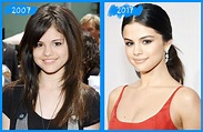 Fotos De Selena Gomez Antes Y Despues