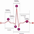 Diagnose Herzinsuffizienz: EKG verstehen | www.herzbewusst.de