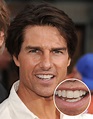 Tom Cruise's Middle Tooth — the Story Behind His Smile | Life & Style