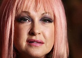 Cyndi Lauper Speaks Out About Her Ongoing Battle With This Skin ...
