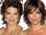 Lisa Rinna Lip Augmentation Plastic Surgery Before and After | Celebie