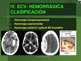 ENFERMEDAD CEREBRO VASCULAR HEMORRAGICA