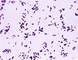 Streptococcus pneumoniae - Agentes biológicos - Bacteria