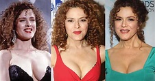 Bernadette Peters Plastic Surgery Before and After Pictures 2024