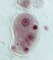 What is the Difference Between Entamoeba Histolytica and Entamoeba ...