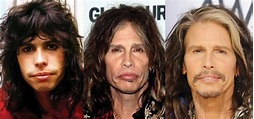 Steven Tyler Plastic Surgery Before and After Pictures 2024