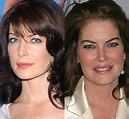 Lara Flynn Boyle Plastic Surgery Before and After Botox Injections ...