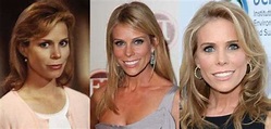 Cheryl Hines Plastic Surgery Before and After Pictures 2024