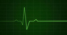 Free photo: Heartbeat Monitor Concept - Molded, Pulse, Procedure - Free ...
