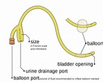 Foley catheter - Wikipedia