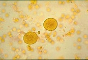 Entamoeba coli Cysts in feces | Medical Laboratories