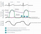 Klinische Elektrokardiographie und EKG-Interpretation – EKG & ECHO