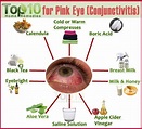 Home Remedies for Pink Eye (Conjunctivitis) | Top 10 Home Remedies