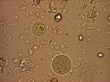 Blastocystis Parasite Blog: Entamoeba