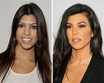 Kardashians before and after photos