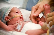 "Life beyond expectations: Baby born 29 weeks premature, weighs 600g ...
