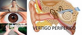 Vértigo Periférico: Síntomas Generales, Causas Comunes, Tipos ...