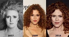 Bernadette Peters Plastic Surgery – A Perfect Look at Old Age ...