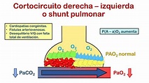 INSUFICIENCIA RESPIRATORIA - Parte 1 (Concepto, Clasificación y ...