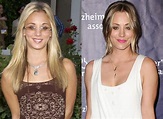 Kaley Cuoco before and after Plastic Surgery (10) – Celebrity plastic ...