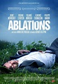 Ablations - Sortiraparis.com