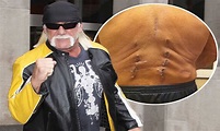 Hulk Hogan shows off graphic puncture wounds on his back after having ...