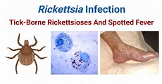 Rickettsia Infection- Tick-Borne Rickettsioses And Spotted Fever