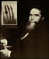 Wilhelm Conrad Röntgen . Rayos X | Spirit photography, X ray, Scientist