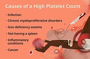 What Causes a High Platelet Count?