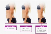 Body Contouring: The Complete Guide | Aesthetics MedSpa