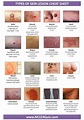 Types of Skin Lesion Cheat Sheet | Nursing student info | Pediatric ...